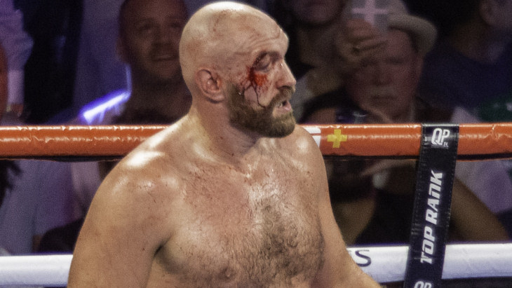 Тайсон Фьюри