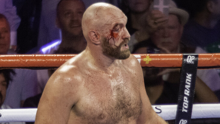 Тайсон Фьюри