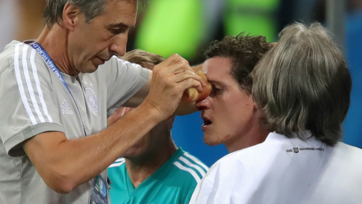 Дебют Руди на Мундиале был недолгим