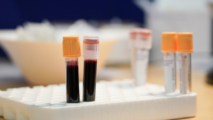 Пробы для тестов на коронавирус