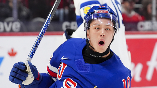 Прогноз на матч Канада U20 — США U20